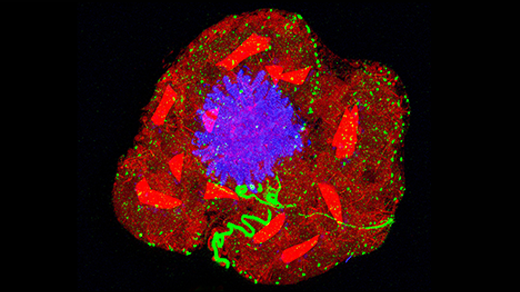 기사 이미지: 팽창 현미경 기술이 세포 세계를 바라보는 방식을 완전히 바꾸어 놓았습니다.