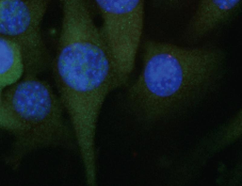 Imagen del artículo: Proteína de repetición de pentatricopeptidos que se dirige a ARN con repetición CUG atenúa la toxicidad de ARN en un modelo de ratón de distrofia miotónica de tipo 1 | Medicina Translacional de la Ciencia