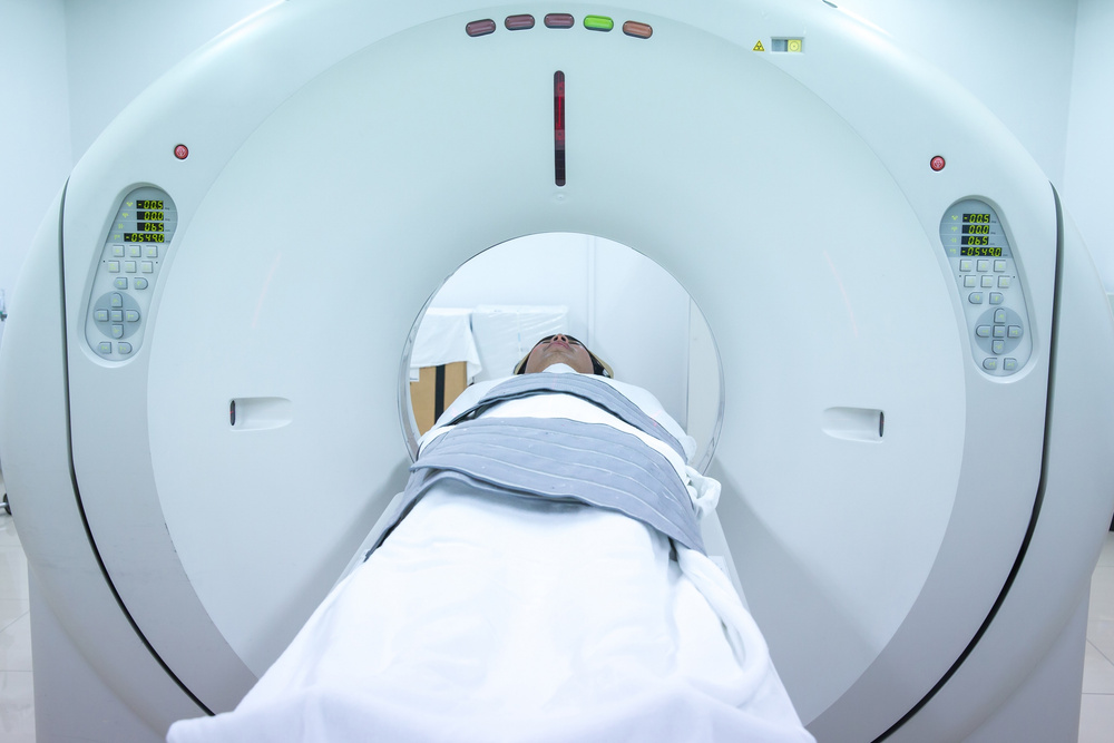 Image for the article: Study highlights cancer risk from millions of CT scans performed annually