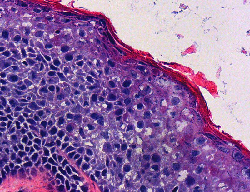 Image for the article: Keratin 16 inhibits type I interferon responses in differentiating keratinocytes of stressed and diseased skin | Science Translational Medicine