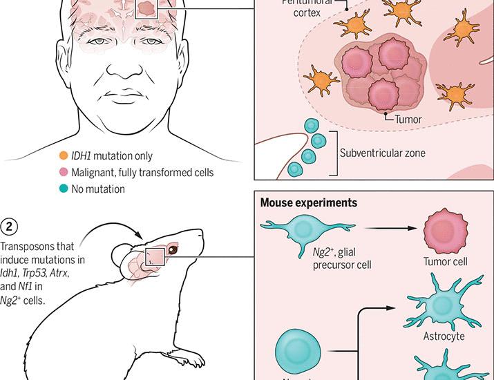 기사 이미지: IDH 돌연변이 교모종의 기원 | 과학