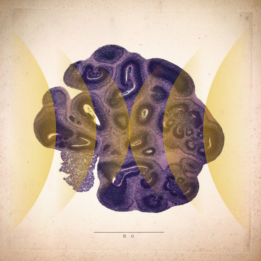 Изображение к статье: Мозговые шары