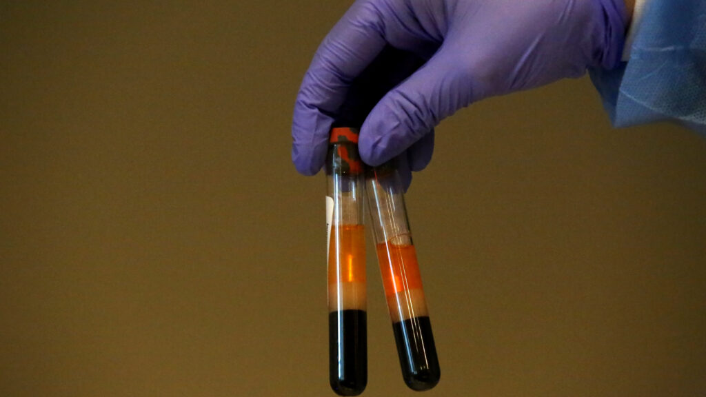 Image for the article: Opinion: Same blood test, different results: Why isn’t this common thyroid screening reliable?