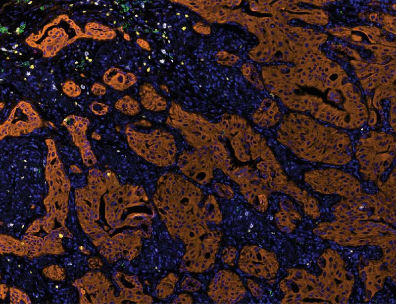 Image for the article: Kras G12C– and G12D–driven lung cancers differ in oncogenic potency, immunogenicity, and relapse after Kras inhibition in mouse models | Science Translational Medicine