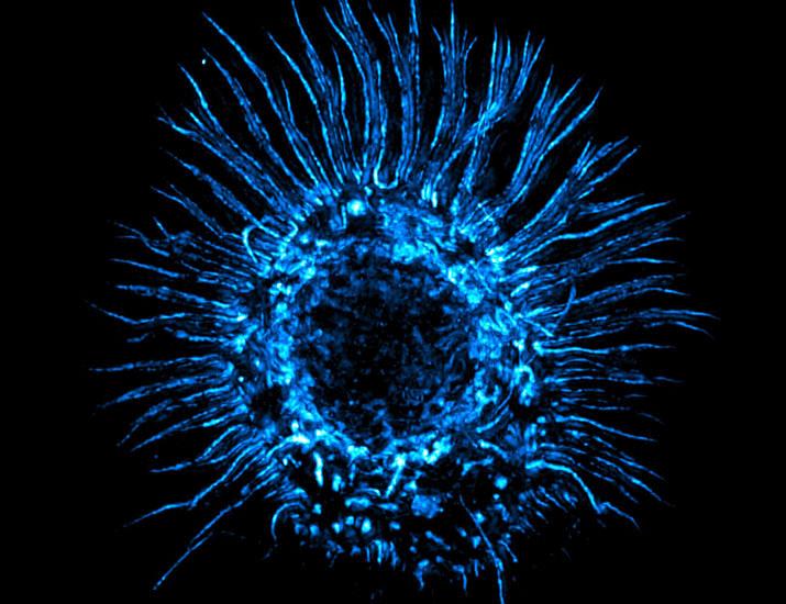 기사 이미지: WASp의 약리학적 활성화는 대식세포 식세포작용을 강화하고 뇌종양 마우스 모델에 대한 이브루티닙의 효능을 향상시킵니다 | 과학 중개 의학