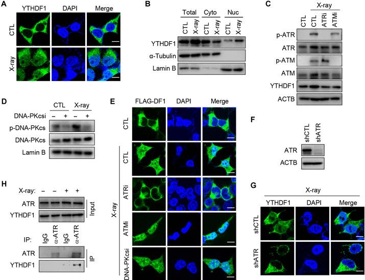 Bild zum Artikel: Kernakkumulation von YTHDF1 reguliert mRNA-Spleißen in der DNA-Schädigungsantwort | Science Advances