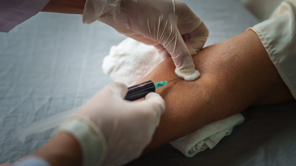 Image for the article: STAT+: Hims, other telehealth platforms push multi-cancer detection tests before evidence of benefit