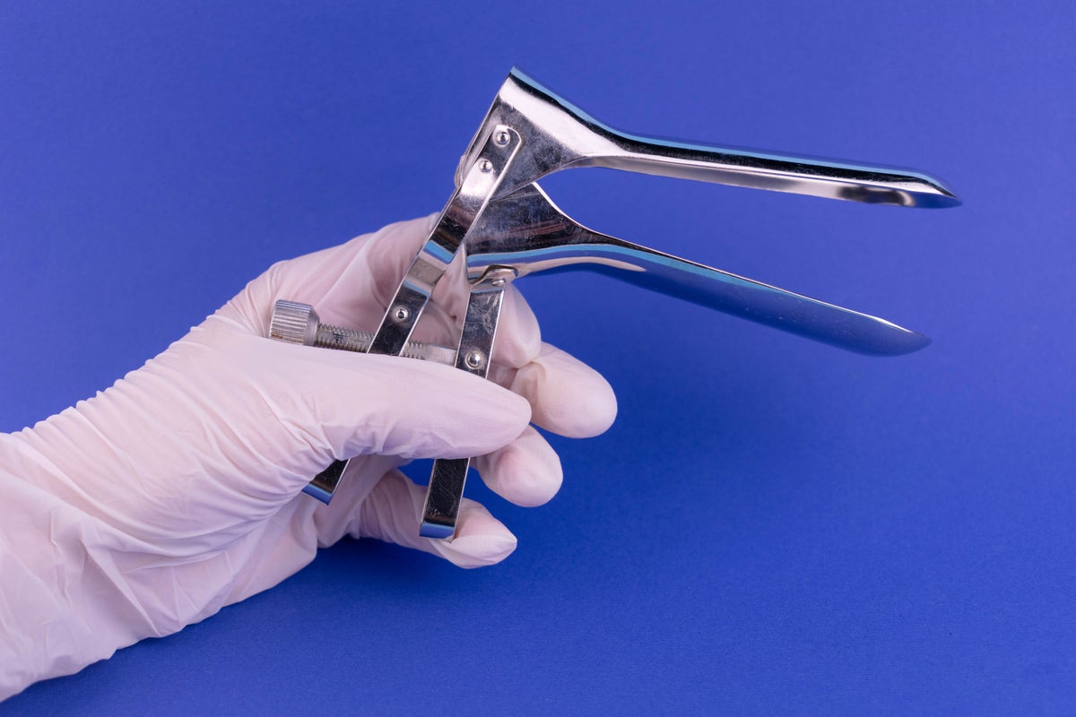 Image for the article: There’s finally a smear test alternative – but why has it taken so long?