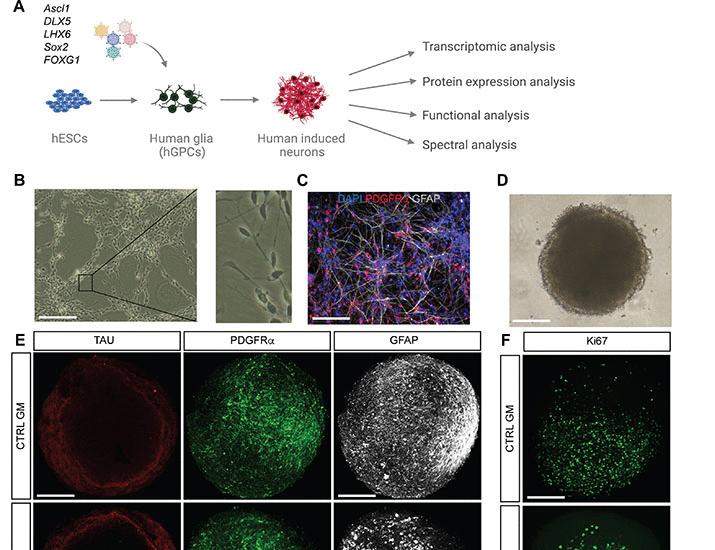 Image for the article: A distinct lineage pathway drives parvalbumin chandelier cell fate in human interneuron reprogramming | Science Advances