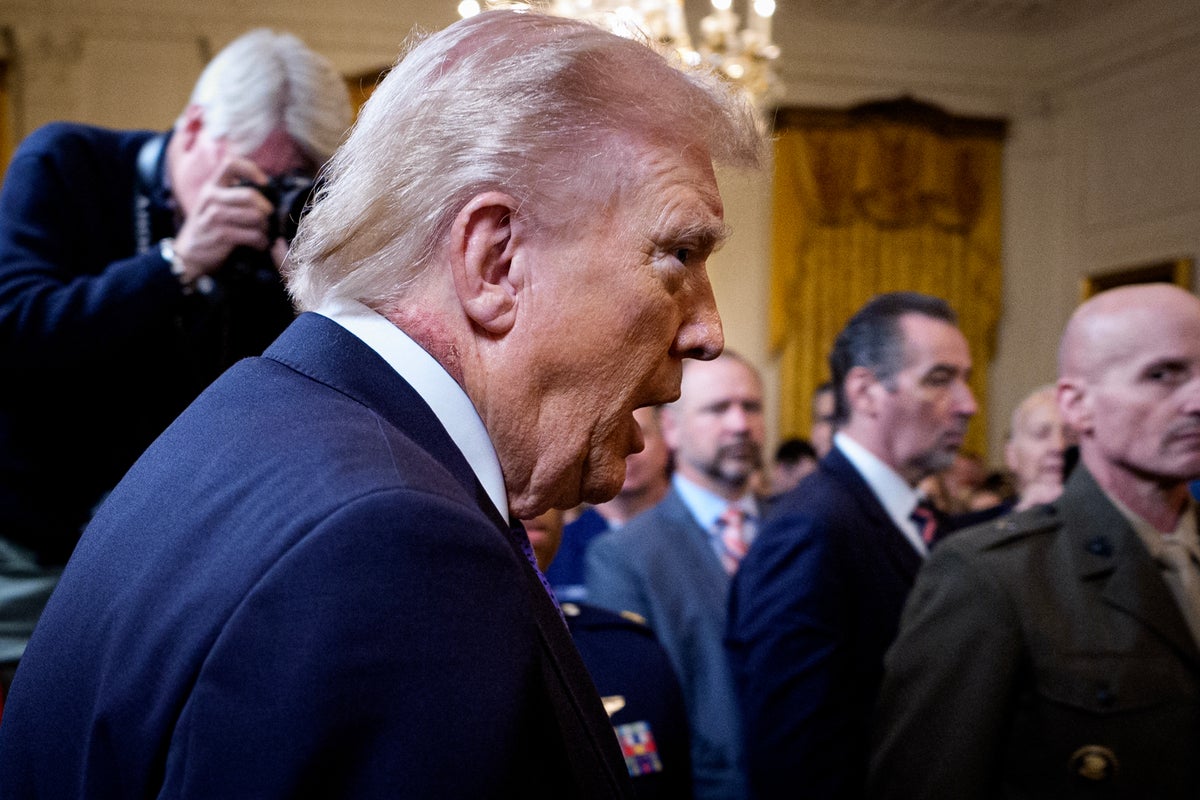 Image for the article: New questions over Trump’s health as he appears with apparent rash on his neck